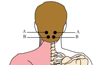 Tinctură tahionizată pentru dureri de cap OS-H15 | Remediu natural pentru migrenă și cefalee 6 os 15 headache migrane cell points1